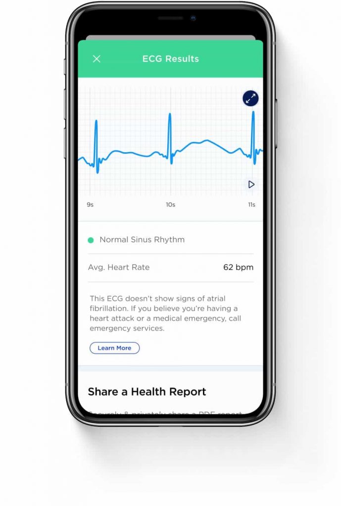 ECG en Health Mate